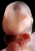 day 32 human embryo photograph