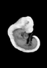 day 33 human embryo MRI animation