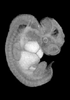 41 day human embryo - MRI animation