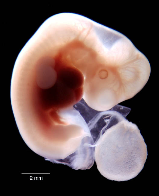 Как выглядит плод в 2 месяца беременности фото