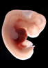 41 day human embryo - optical image