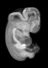 day 47 human embryo MRI animtaion