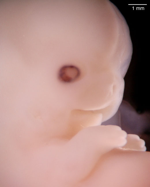 human embryo photograph
