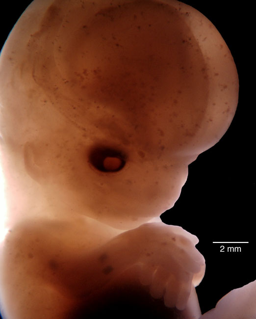 human embryo photograph